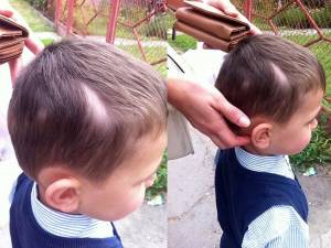 Băieţelul prezintă leziuni la nivelul capului și are nevoie de 4-5 zile de îngrijiri medicale