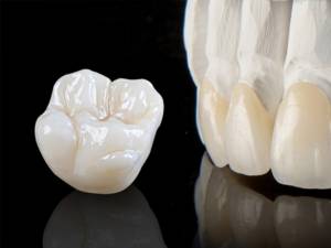 Care varianta este mai buna dintre coroana metalo-ceramica si coroana din zirconiu?