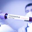 Încă șase cadre didactice depistate cu coronavirus Foto jurnalulolteniei.ro